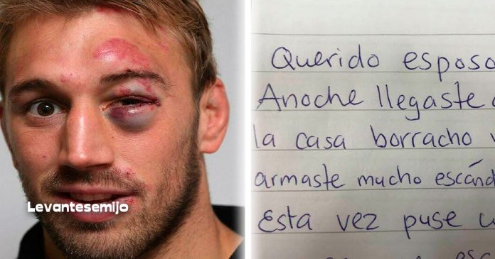 desperto-con-ojo-negro-y-resaca